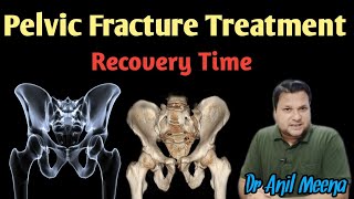 Pelvic Fracture Recovery Time  pelvic Fracture Treatment  pelvic Fracture Exercises  in Hindi [upl. by Llenahc]