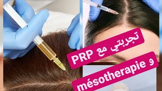 تجربتي مع PRP و mesotherapie للشعر الأجوبة على كل أسئلتكم بكل مصداقية🤗🤗 [upl. by Ravel]