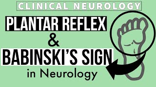 PLANTAR REFLEX  BABINSKIs SIGN  Equivocal Plantar  Other methods  Clinical Neurology [upl. by Fifi]