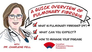 So Youve Been Diagnosed with Pulmonary FibrosisWhats Next [upl. by Lancaster56]