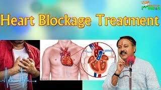 Heart Blockage Treatment  Rajiv Dixit [upl. by Drud]