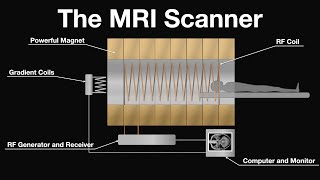 MRI Scan Animation  How magnetic resonance imaging works [upl. by Nwahsir393]