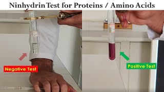 Ninhydrin Test [upl. by Edrahs]