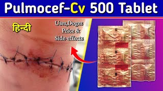 Pulmocef Cv 500 Tablet  Cefuroxime axetil Tablets Review in Hindi  by Mt discuss [upl. by Armanda]