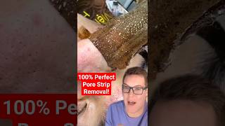 😍 Perfect PORE STRIP REMOVAL shorts [upl. by Icrad]