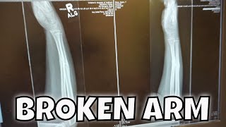 OWEN GETS CRAZY NEWS ABOUT HIS BROKEN ARM [upl. by Nellac]