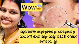 Clear skin ആവാൻ ഇത് ഉപയോഗിച്ചുനോക്കൂ  ഔഷധകൂട്ട്  wow [upl. by Lemon]