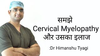 समझे Cervical Myelopathy और उसका इलाज [upl. by Gillespie]