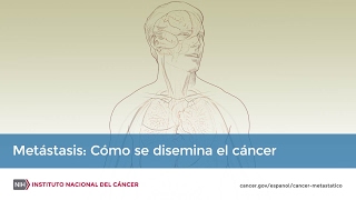 Metástasis Cómo se disemina el cáncer [upl. by Wyn]