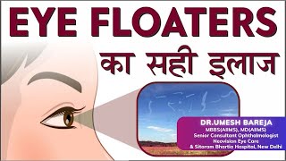 Eye Floaters  Cause amp Treatment  Risks amp Management of Floaters  Dr Umesh Bareja  Eye Specialist [upl. by Mctyre237]