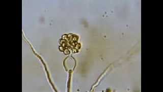 Release of Zoospores by Pythium [upl. by Atirec]