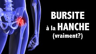 Bursite à la hanche si la douleur provenait plutôt des muscles fessiers [upl. by Wulf]