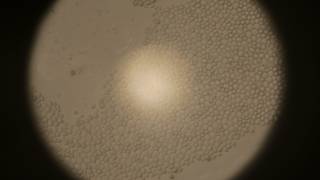 Yeast cells under the microscope [upl. by Cybil]