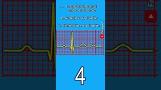 Electrocardiograma interpretación ¿Qué cambios en el segmento ST deben considerarse de importancia [upl. by Colville989]