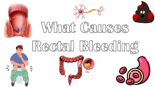 BLOOD IN STOOL  Other Signs You Have to Check [upl. by Isadora]