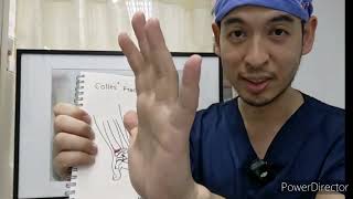 กระดูกข้อมือหัก Colles Fracture [upl. by Aynos]