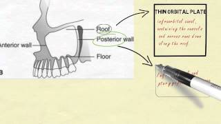 Anatomy of maxillary sinus [upl. by Sirtimed449]