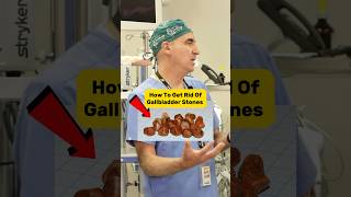 How to get rid of gallbladder stones shorts [upl. by Sorci353]