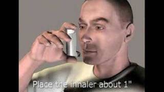 3D Medical Animation Inhaler [upl. by Atsirak]