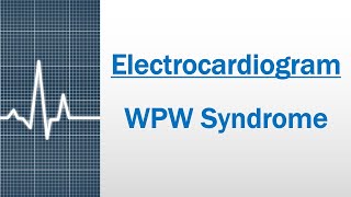 WPW syndrome Electrocardiogram [upl. by Eanrahs]