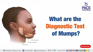 Mumps Diagnosis  What are the Diagnostic Test of Mumps  mumps [upl. by Cerelly]