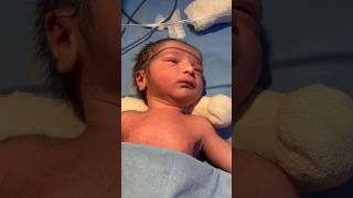 GRUNTING🙏🙏🙏🙏youtubeshorts medical newborn viral [upl. by Odnanreh]