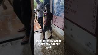 duchenne muscular dystrophy patient gait  toe walking [upl. by Navar]