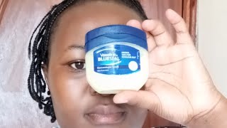 I used Vaseline on my face for one week Look at my skin now🙆 skincareroutine vaselineonface [upl. by Hsoj]