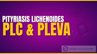 Pityrisis Lichenoides  PLC PLEVA [upl. by Elbys826]