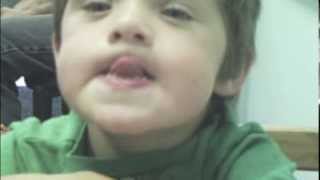 Dariens Journey with Childhood Apraxia of Speech [upl. by Gregor]