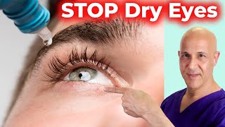 Soothe and Heal DRY EYES Naturally Dr Mandell [upl. by Eloisa]