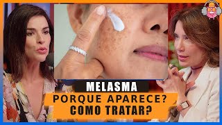 A Melhor explicação sobre Mancha no Rosto de MELASMA como aparece e como tratar [upl. by Catherin]