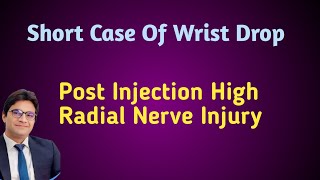 How To Check Radial Nerve Clinically [upl. by Ardin143]