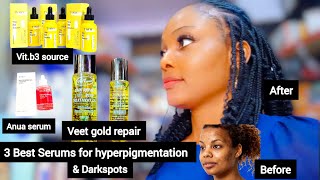 BEST FACE SERUMS FOR A GLOWING SKIN HOW TO CLEAR HYPERPIGMENTATION QUICKLY  FACE amp BODY TREATMENT [upl. by Caruso]