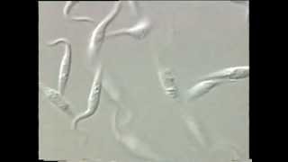 Trypanosoma [upl. by Elsilrac855]