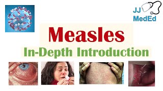 Introduction to Measles  Causes Risk Factors Transmission Stages of Infection Signs amp Symptoms [upl. by Niarbo541]