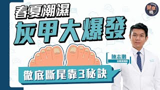 健身美甲暗藏灰甲陷阱？3秘訣徹底斷尾｜近半人灰甲復發 全因選錯產品？｜註冊藥劑師拆解 治灰甲偏方迷思｜健康嗎HealthCodeHK 【Chat醫D】onychomycosis [upl. by Celina]