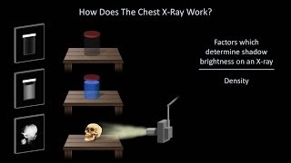 How to Interpret a Chest XRay Lesson 1  An Introduction [upl. by Manly254]