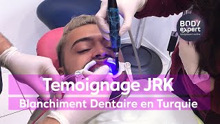 Témoignage Blanchiment Dentaire Turquie JRK [upl. by Gildea109]