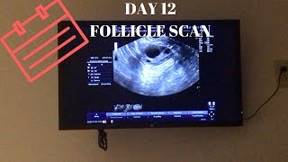 DAY 12 FOLLICLE SCAN [upl. by Royce]