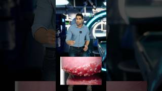 ஆணுறுப்புக்குள் சிறு பருக்களா Pearly penile papules Dr Isacc Abbas [upl. by Alda800]