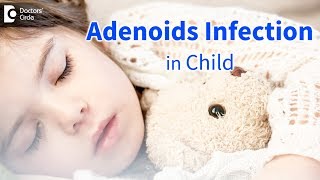 Infected adenoids in children Signs Symptoms Diagnosis  Dr Satish Babu K [upl. by Stilu]