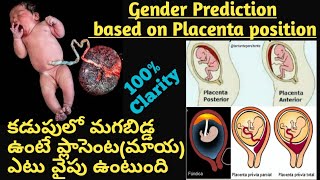 Baby Gender Prediction by Placenta II Placenta positions during pregnancyII Posterior means baby boy [upl. by Raquel]