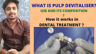 what is pulp devitaliser  how and when to use it [upl. by Nauqas97]