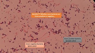 Gram positive and Gram negative bacterial slides under the Microscope [upl. by Yasui]