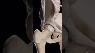 Hip Arthrosis When the Hip Joint Wears Down 🦴📚🥼 medical doctor ortho bone shortvideo video [upl. by Adekahs]