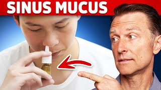 The 1 Remedy for Sinus Mucus  Pressure  Postnasal Drip [upl. by Lona430]