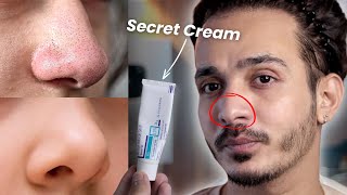 OMG This Cream Erases Blackheads amp Whiteheads Like Magic 😱 [upl. by Branscum]