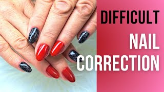 Difficult Nail Correction [upl. by Notterb642]