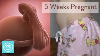 5 Weeks Pregnant What You Need To Know  Channel Mum [upl. by Leur]